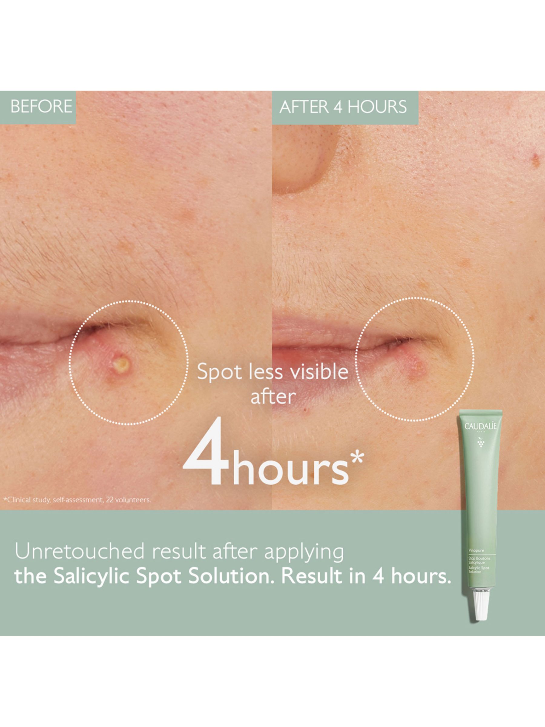 Caudalie Vinopure Salicylic Spot Treatment, 15ml 2