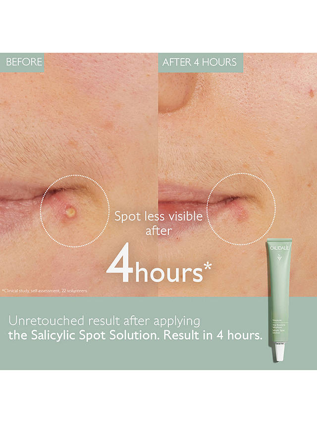 Caudalie Vinopure Salicylic Spot Treatment, 15ml 2