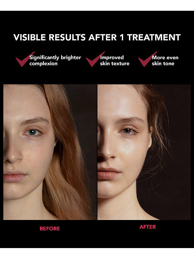 FOREO FAQ™ 201 LED Anti-Ageing Face Mask Treatment 4