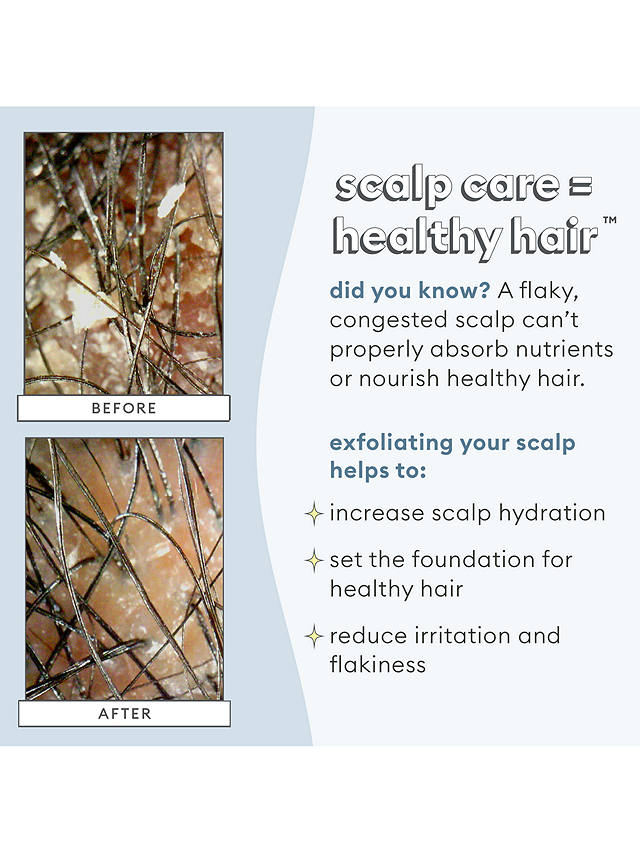 Briogeo Scalp Revival™ Charcoal + Coconut Oil Micro-Exfoliating Shampoo, 236ml 6