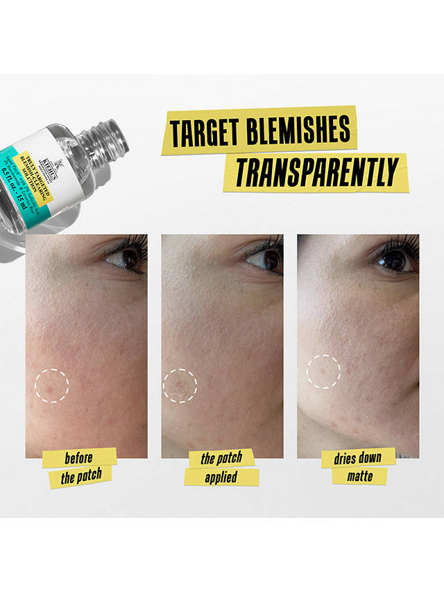 Kiehl's Truly Targeted Blemish-Clearing Solution, 15ml 4
