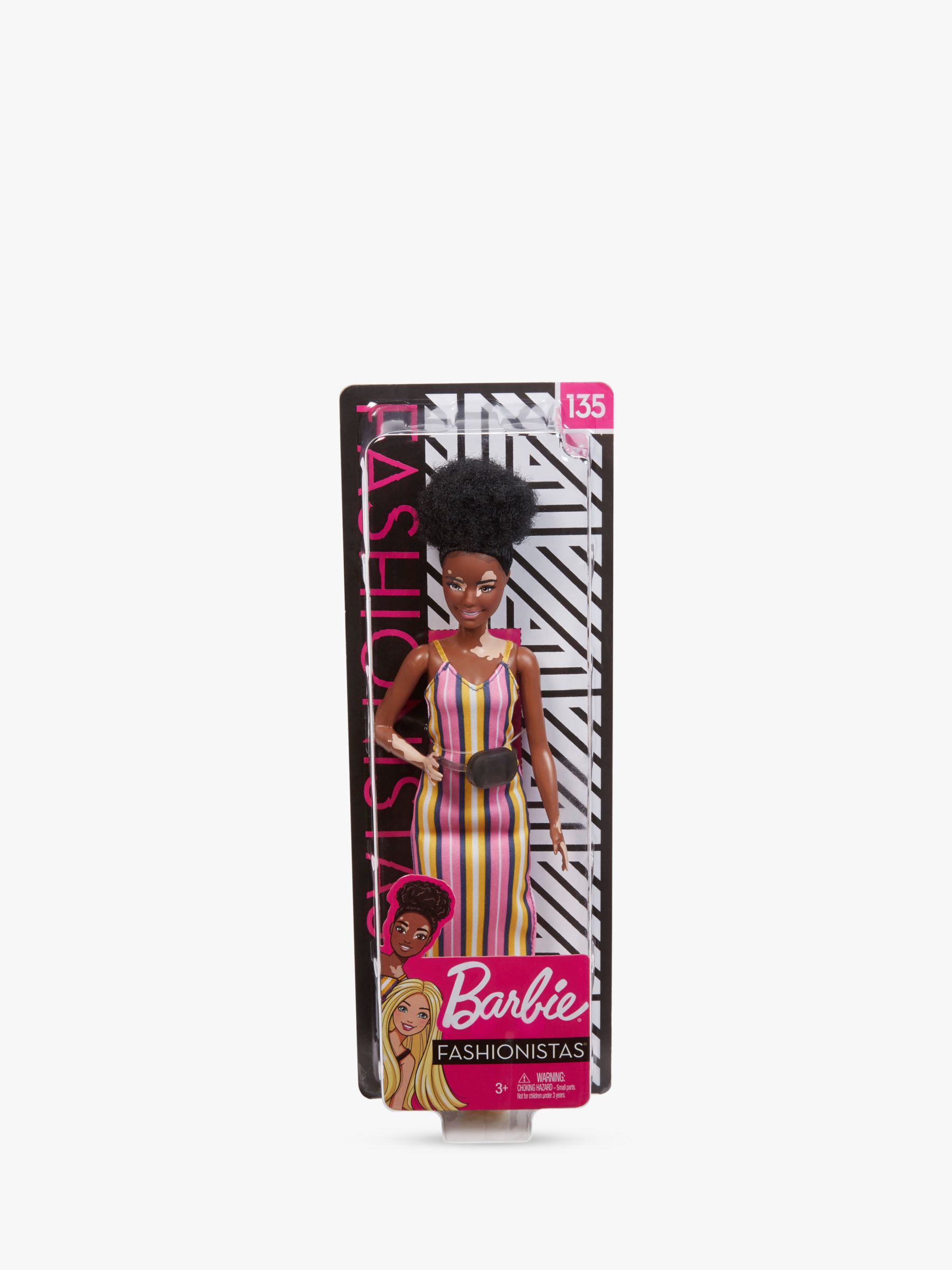 barbie vitiligo doll