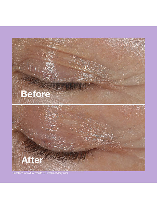 Clinique Smart Clinical Repair™ Wrinkle Correcting Eye Cream, 15ml 4